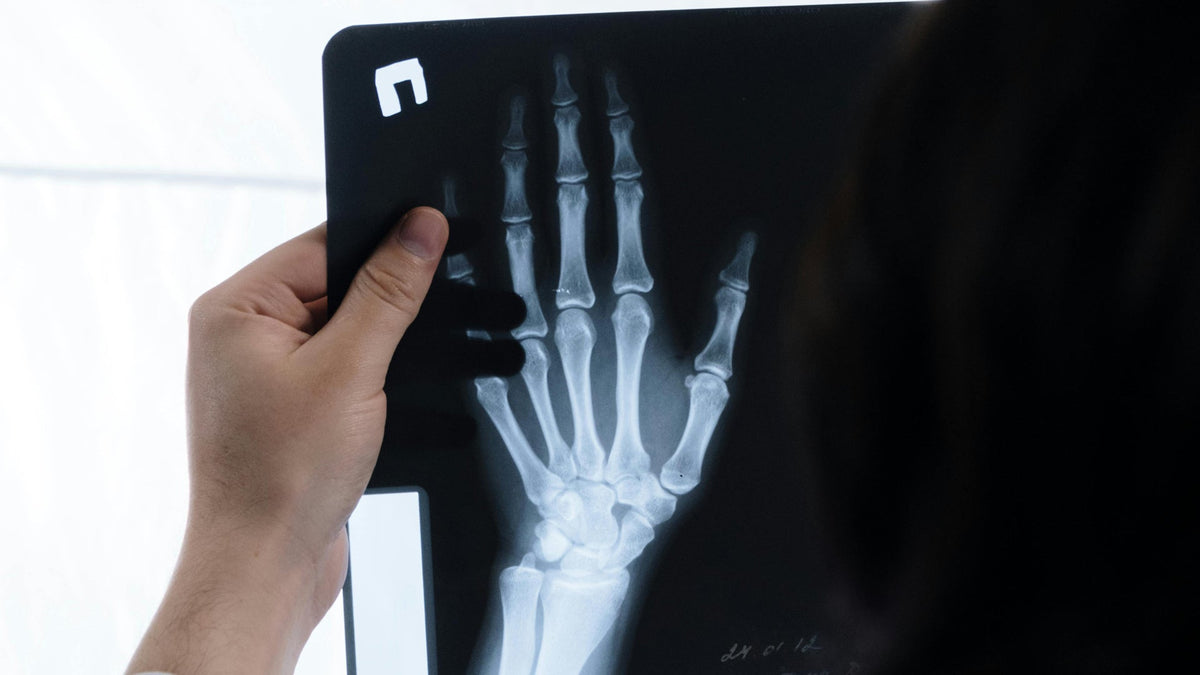 Bone Health for Nine Realms Products Use