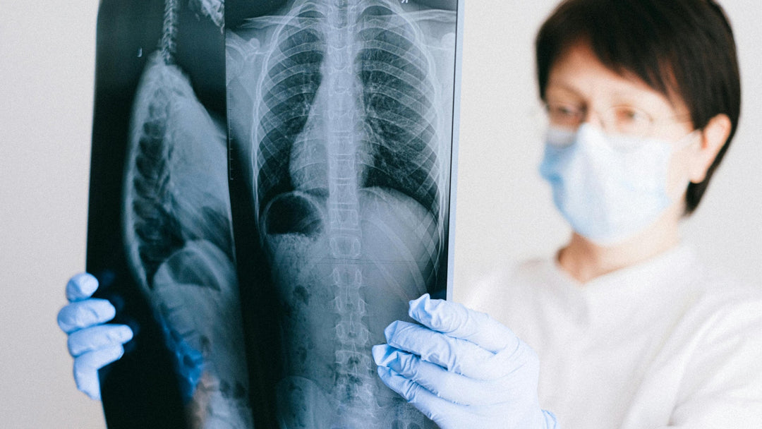 Cannabis und die Gesundheit der Lunge: Erläutert